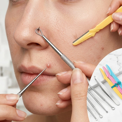 Shazory blackhead remover styled lifestyle shot